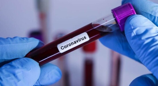 Brasil passa de 78 mil casos de Covid-19