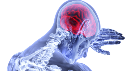 Doença cerebral misteriosa intriga médicos no Canadá