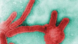 virus-de-marburg-semelhante-ao-ebola-identificado-em-paciente-morto-no-guine