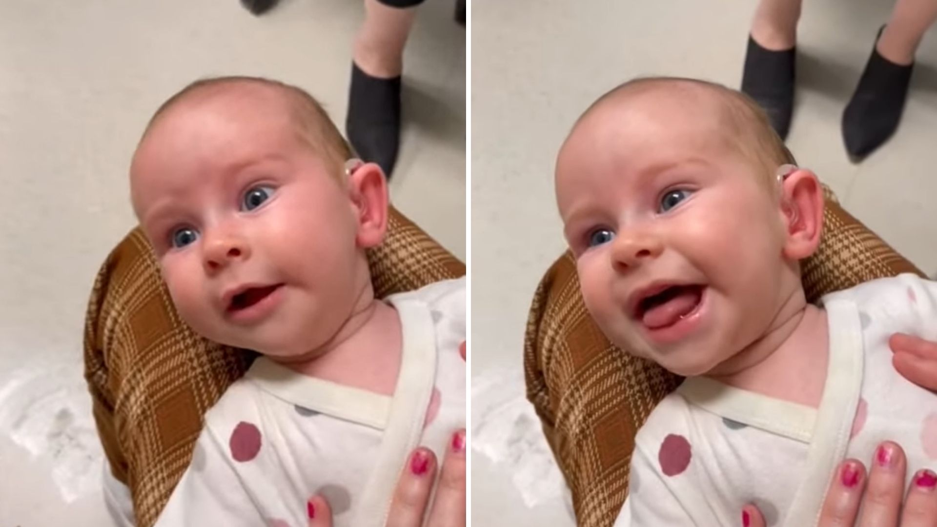 Com aparelho auditivo, bebê emociona ao ouvir pais pela primeira vez