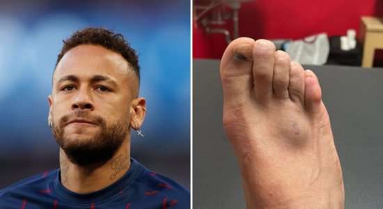 neymar ferimento no pé